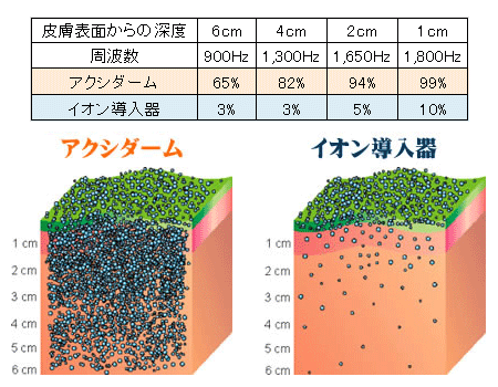 導入系 アクシダーム イオン導入