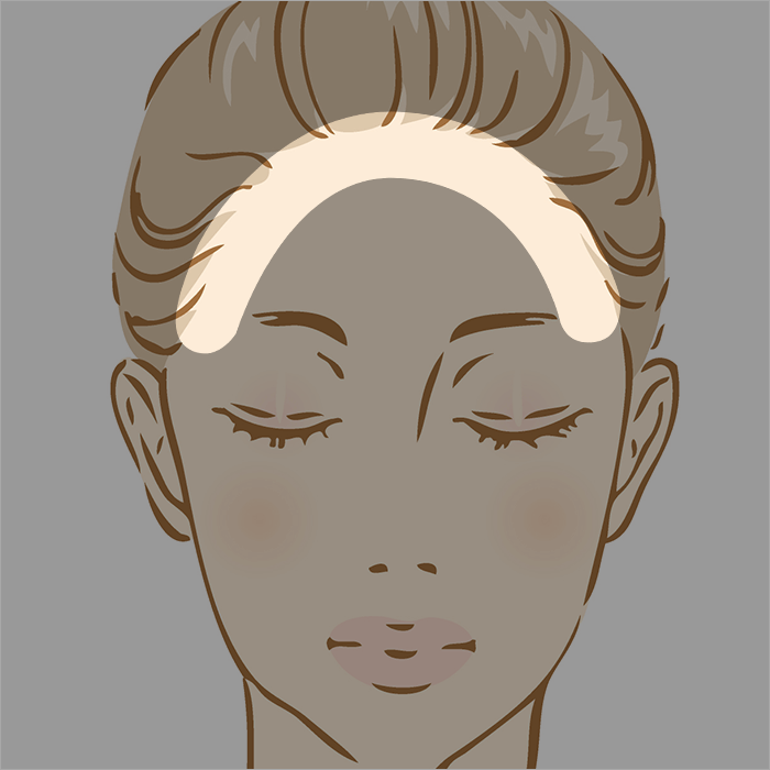 生え際 ヘアライン