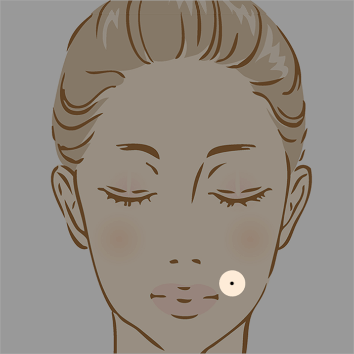 ほくろ