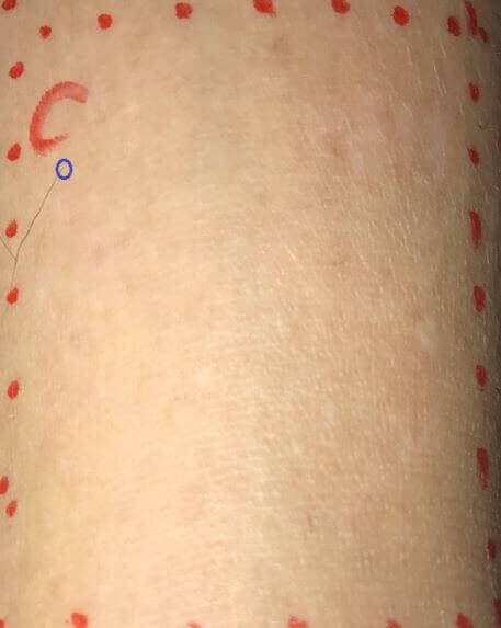 男性のすね毛の脱毛効果を自ら検証！比べてみました。
