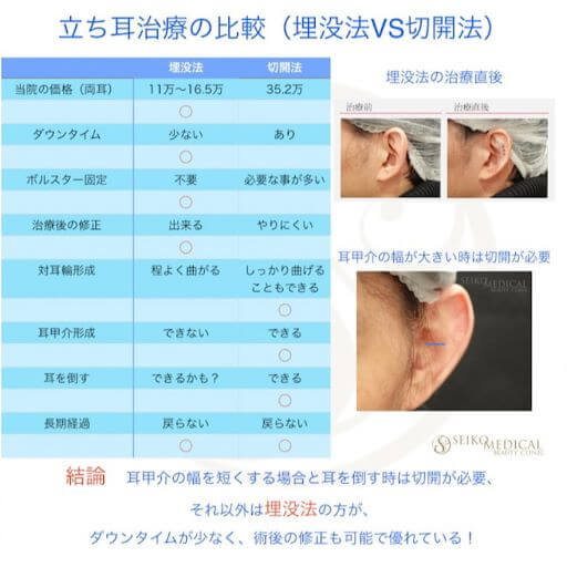 【切らない立ち耳治療】6年以上の長期経過について