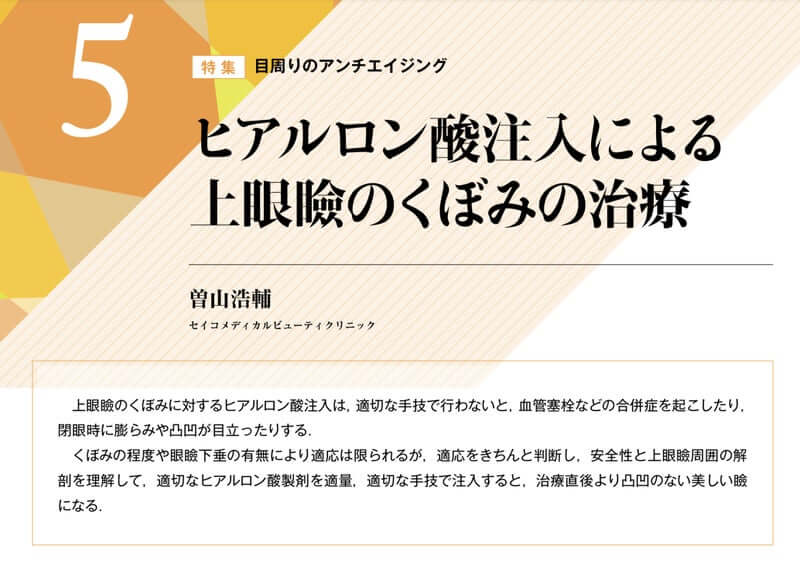 くぼみ目の方へのヒアルロン酸注入について執筆しました。