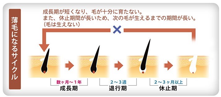 薄毛になるヘアサイクル