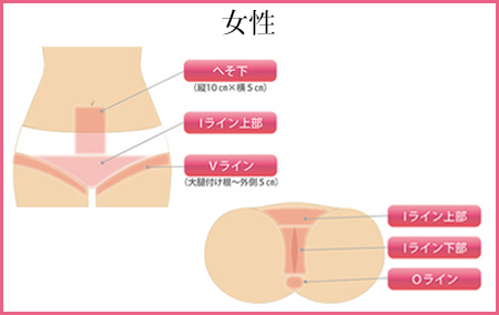 女性 脱毛 部位