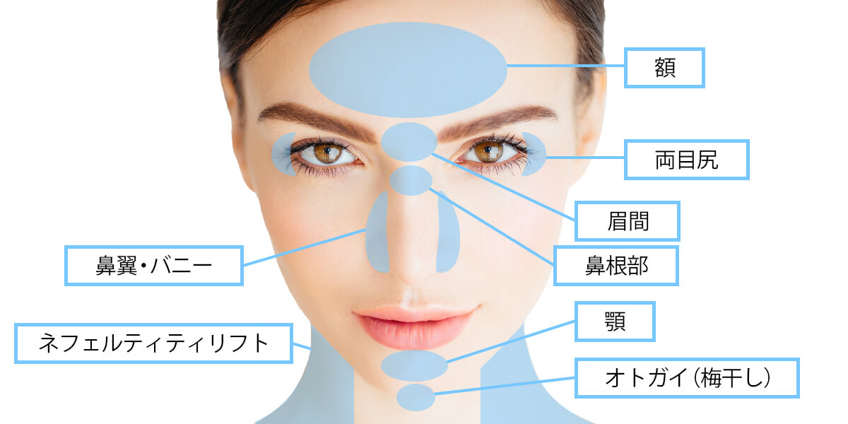 額 眉間 両目尻 鼻翼 バニー 鼻根部 顎 ネフェルティティリフト オトガイ梅干し