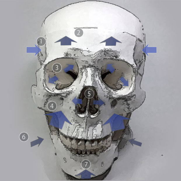 眼窩（目のくぼみ）の拡大 側頭部の陥凹 前頭骨の陥凹 上顎骨の縮小と後退、梨状口の拡大 顎の突起の減少、短縮